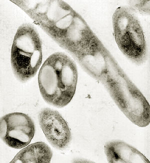 Bacillus Anthracis treatment