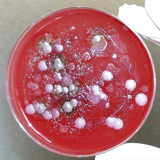 Bacillus Anthracis diagnostic